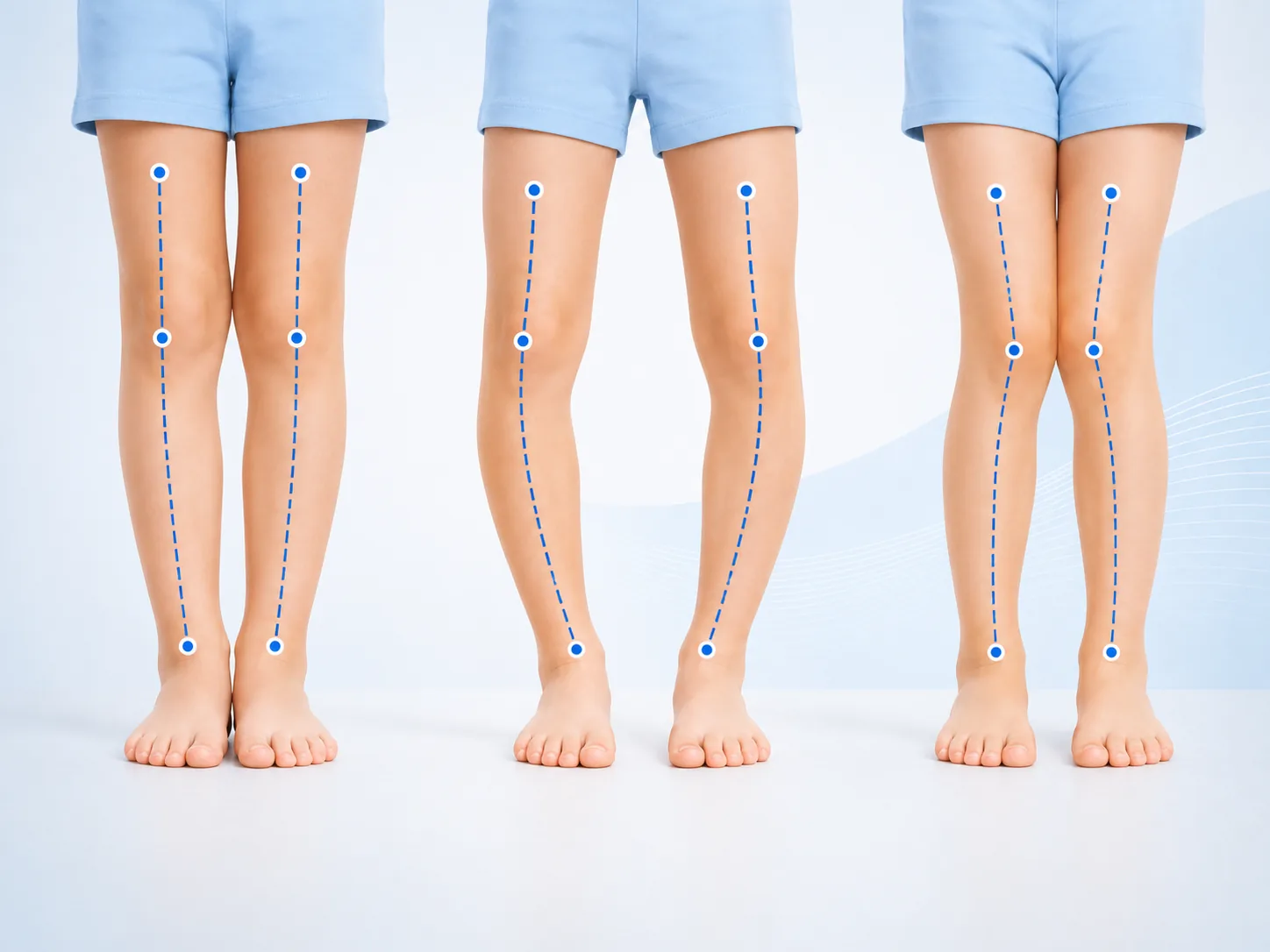 Children Feet Issues — illustration